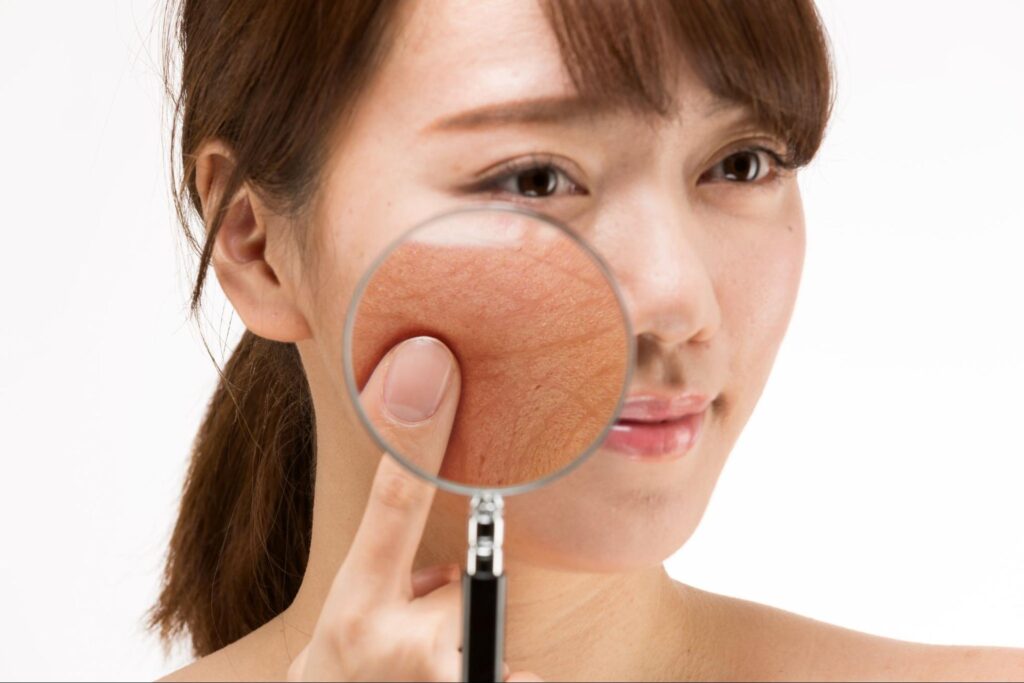 虫めがねで女性の顔の毛穴を拡大している画像
