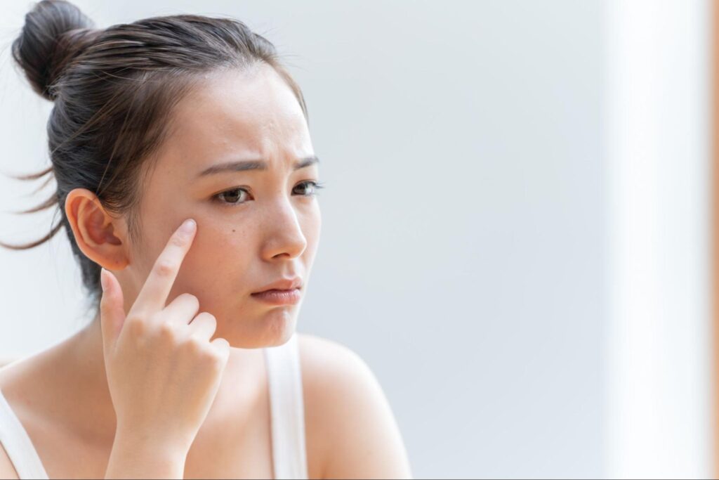 肌悩みがあり浮かない表情の女性