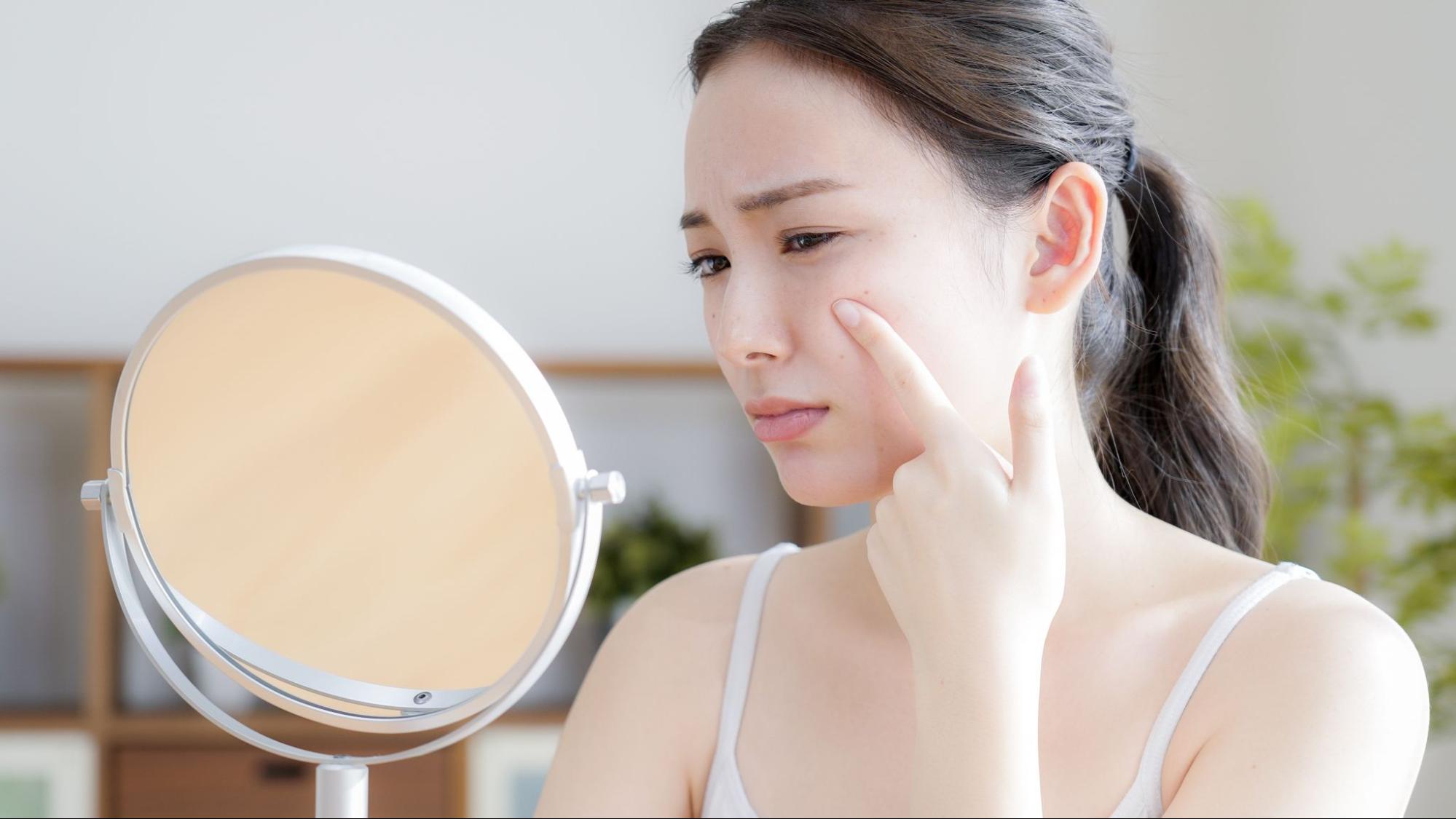 肌悩みがあり浮かない表情で鏡を見ている女性